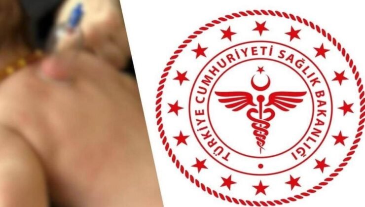 Bebeklere hacamat uygulaması tartışmalara neden oldu! Doç. Dr. Boray Baysal son noktayı koydu