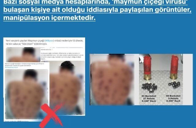 DMM’den ‘maymun çiçeği’ paylaşımlarına yalanlama