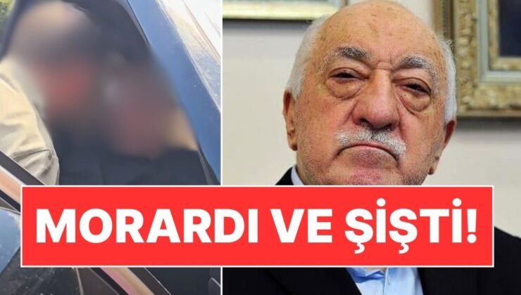 FETÖ Elebaşı Fetullah Gülen’in Gündem Olan Görüntüsü: Yüzü Şiş ve Mosmor!