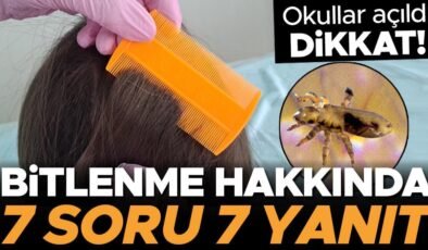 Okul döneminde sayısız çocuk bitleniyor… Önlemenin yolları var mı? Bitlenme sonrası neler yapılmalı? Her ebeveynin bilmesi gereken 7 SORU 7 YANIT