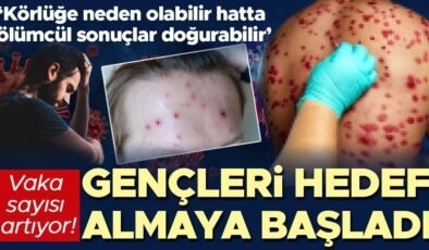 Zona vakaları artıyor! Gençleri hedef almaya başladı… ‘Körlüğe neden olabilir hatta ölümcül sonuçlar doğurabilir’