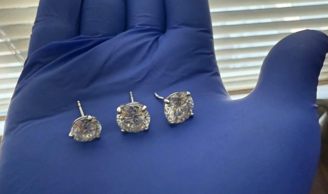 ABD, – ABD’nin Florida eyaletinde bir kişinin çaldıktan sonra yuttuğu