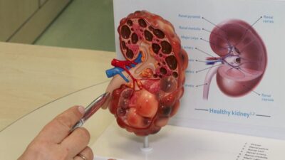 Devran GÜNDÜZ- Ataberk KURT/ İSTANBUL, – HER yıl mart ayının