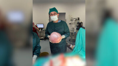 MALATYA, – MALATYA’da karın ağrısı şikayeti ile hastaneye giden Semra