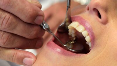 Ağız ve diş sağlığı kesinlikle ihmal edilmemeli. Çünkü ihmal edilen