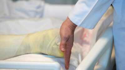 Sağlık Bakan Yardımcısı Nurullah Okumuş, yanık vakalarında ortaya çıkan komplikasyonların