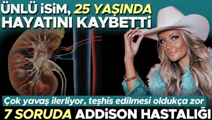 TikTok yıldızı Taylor Rousseau Grigg, 25 yaşında hayatını kaybetti. Hastalık çok yavaş ilerliyer ve teşhisi oldukça zor |7  SORUDA ADDİSON HASTALIĞI